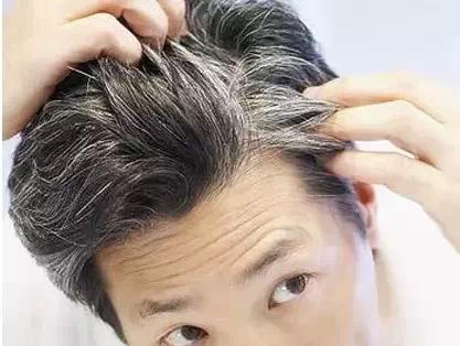 長白發(fā)是因為身體缺乏營養(yǎng)？該如何改善